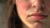 Litifilimab cutaneous lupus erythematosus