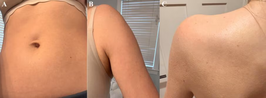 Figure 2: Postpartum follow-up photographs